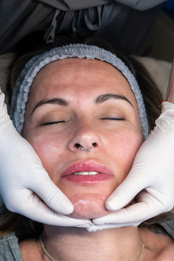 tratamiento-facial-2