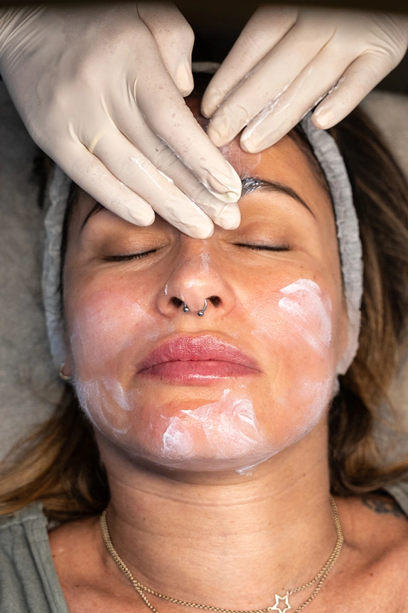 tratamiento-facial